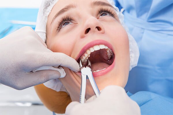 Простое и сложное удаление зубов, сколько стоит срочно удалить зуб?