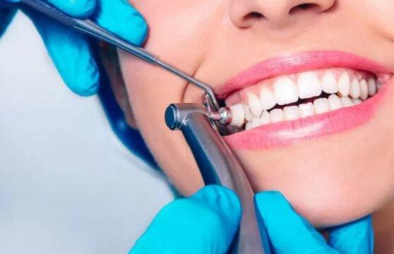 Профессиональная гигиена зубов и ее преимущества
