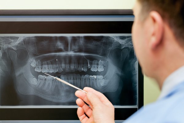 Ортопантомограмма: цифровой снимок зубов
